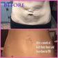 Body Boost - BEST SELLING CELLULITE CREAM - VALGINA.com