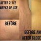 Hƒìli - Stretch Mark Minimizing Oil - IN STOCK - 36 LEFT! - VALGINA.com