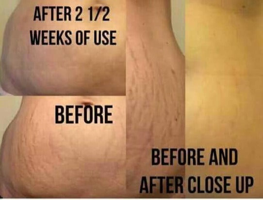 Hēli - Stretch Mark Minimizing Oil - IN STOCK - 36 LEFT! - Pure Romance